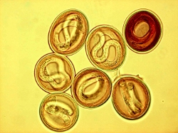 Medical Parasitology Photo